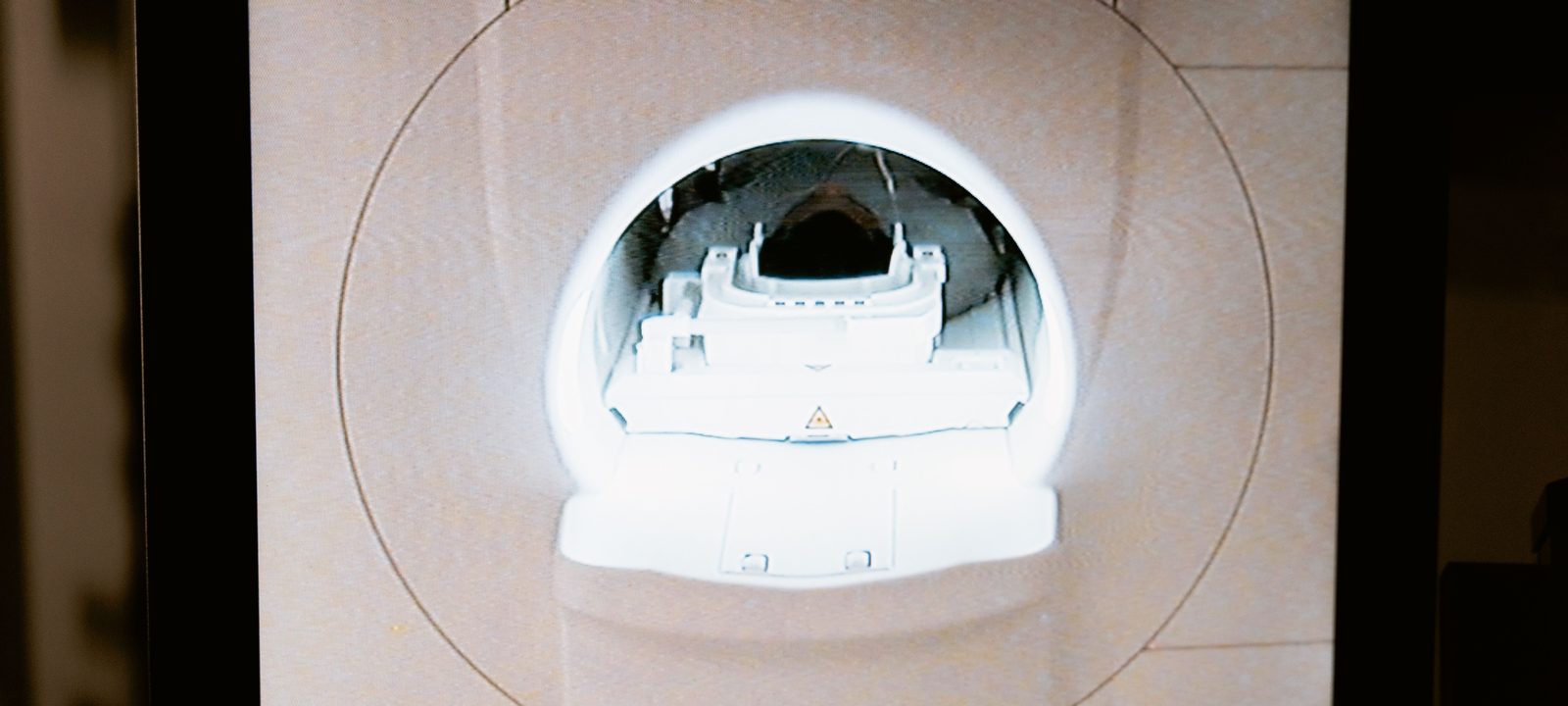 Close-up of an MRI scanner displayed on a monitor in a medical clinic.